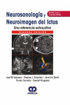Neurosonología y Neuroimagen del Ictus. Una Referencia Exhaustiva + Acceso a Contenidos Online | 9789804300165 | Portada