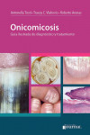 Onicomicosis | 9789874922076 | Portada