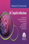 Bronquitis infecciosas. Principales retos de avicultura | 9788417225896 | Portada