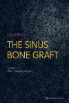 The Sinus Bone Graft | 9780867157918 | Portada