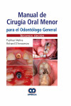 Manual de Cirugía Oral Menor para el Odontólogo General | 9789804300349 | Portada