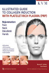 Kolster/Paasch: Illustrated Guide to Collagen Induction with Platelet-Rich Plasma (PRP) | 9781786980298 | Portada