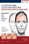 Kolster/Paasch: Illustrated Guide to Collagen Induction with Platelet-Rich Plasma (PRP) | 9781786980298 | Portada