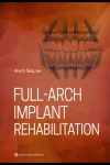 Full-Arch Implant Rehabilitation | 9780867158090 | Portada