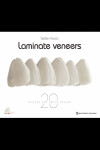 Laminate Veneer 20 Recipes for Smile Design | 9782366150551 | Portada