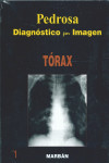 Diagnóstico por Imagen, Vol. 1: Tórax | 9788471015938 | Portada