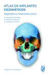 ATLAS DE IMPLANTES CIGOMÁTICOS: Diagnóstico y tratamiento clínico | 9788494231896 | Portada