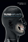 Tilted Implants: Implant-Prosthetic Rehabilitation of the Atrophic Patient | 9780867158182 | Portada
