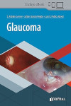 Glaucoma + ebook | 9789874922724 | Portada