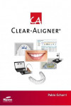 Clear Aligner (Deutsch) | 9788494055423 | Portada