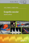 Ecografía Vascular + ebook | 9789874922854 | Portada
