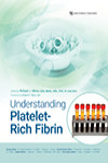 Understanding Platelet-Rich Fibrin | 9781647240493 | Portada