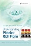 Understanding Platelet-Rich Fibrin | 9781647240493 | Portada
