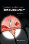 Periodontal and Peri-implant Plastic Microsurgery | 9780867158199 | Portada