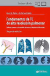 Fundamentos de TC de Alta Resolución Pulmonar + ebook | 9789874922953 | Portada