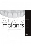 Esthetic Implants How to think about complex cases in anterior areas with a global approach to the patient smile | 9788821453267 | Portada