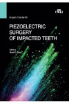 Piezoelectric surgery of impacted teeth | 9788821453083 | Portada