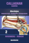 Callaghan Cadera 2: Abordajes. Osteonecrosis. Evaluación. Perioperatorio | 9788418068430 | Portada