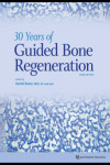 30 Years of Guided Bone Regeneration | 9780867158038 | Portada