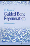 30 Years of Guided Bone Regeneration | 9780867158038 | Portada