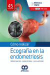 Cómo Realizar Ecografía en la Endometriosis | 9789585348905 | Portada