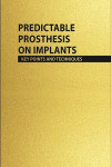 Predictable Prosthesis on Implants, Key Points and Techniques | 9788487673573 | Portada