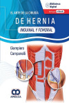 El Arte de la Cirugía de Hernia. Inguinal y Femoral | 9789585348721 | Portada