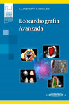 Ecocardiografía Avanzada + ebook | 9788491108375 | Portada