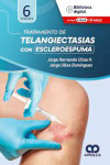 Tratamiento de Telangiectasias con Escleroespuma | 9789585349247 | Portada