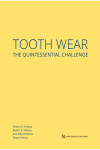 Tooth Wear The Quintessential Challenge | 9781786981202 | Portada