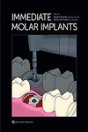 Immediate Molar Implants | 9780867159547 | Portada