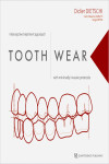 TOOTH WEAR. INTERCEPTIVE TREATMENT APPROACH WITH MINIMALLY INVASIVE PROTOCOLS | 9781786981158 | Portada