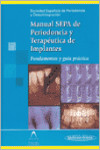 Manual S.E.P.A. de Periodoncia y Terapéutica de Implantes | 9788479038793 | Portada