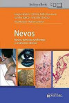 Nevos. Nevos, Tumores Neviformes y Síndromes Névicos | 9789878452418 | Portada