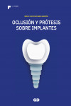 Oclusión y Prótesis sobre Implantes | 9788412773705 | Portada