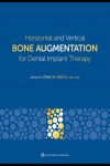 Horizontal and Vertical Bone Augmentation for Dental Implant Therapy | 9781647241254 | Portada