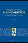 Horizontal and Vertical Bone Augmentation for Dental Implant Therapy | 9781647241254 | Portada