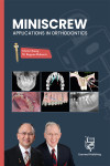 MINISCREW Applications in orthodontics | 9791399006001 | Portada