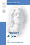 Trasplante de pelo + DVD-ROM | 9788480862004 | Portada