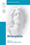 Blefaroplastia | 9788480862103 | Portada