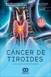 Cáncer de Tiroides. Masterclass Suite I-Oncology PET-CT-RM | 9786287681859 | Portada