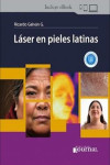 Láser en Pieles Latinas | 9786319116885 | Portada