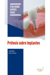 Prótesis sobre implantes | 9791388085727 | Portada