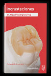 Incrustaciones. Manual clínico | 9791399153088 | Portada