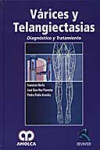 Varices y telangiectasias | 9789588328126 | Portada